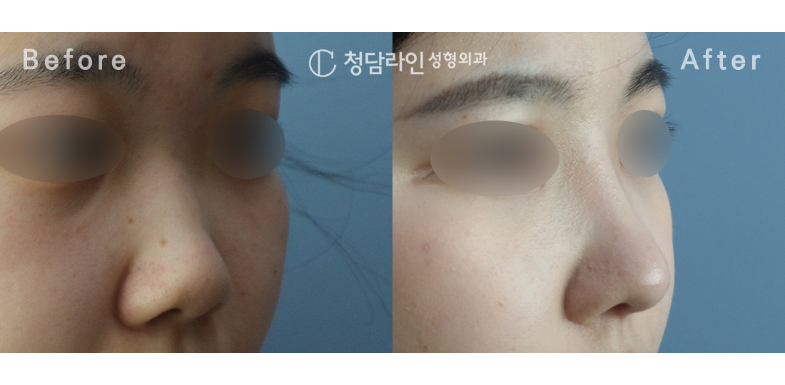 Before Image 3