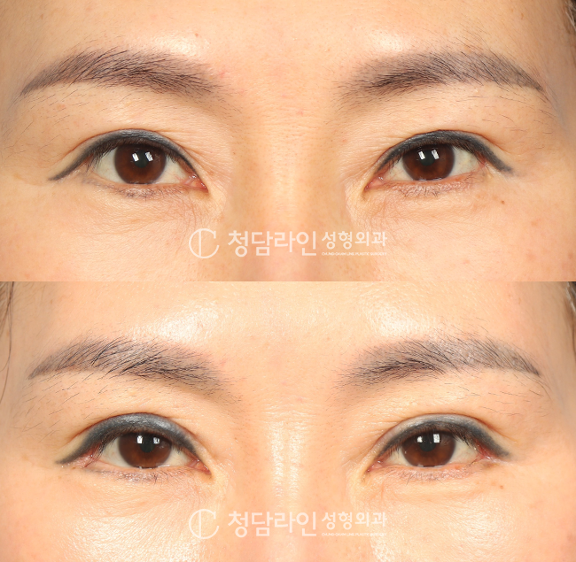 Before Image