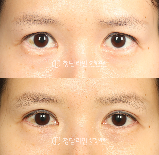 Before Image