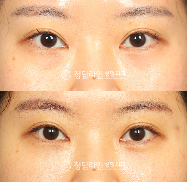 Before Image