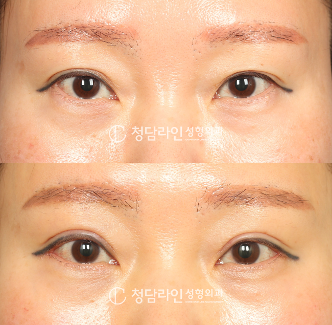 Before Image