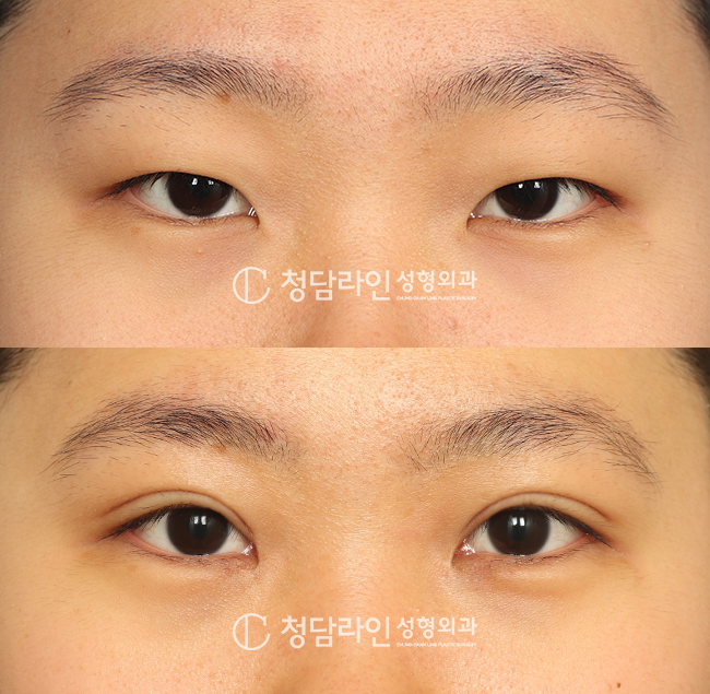 Before Image